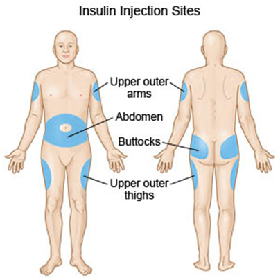 place to take insulin injection in body